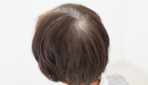 女性のつむじはげの原因と正しいヘアケア方法