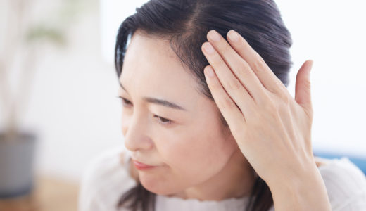 分け目が薄い女性は多い？年齢関係なく薄毛になるの？