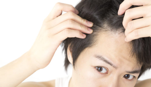 髪の毛の生え際後退の悩み、原因と効果的な対策とは？