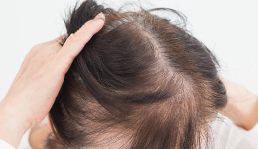 髪の毛が細くなったと悩んでる女性は意外と多い