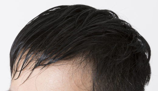 髪の毛が油っぽくてベタベタする？原因と正しいケアを紹介